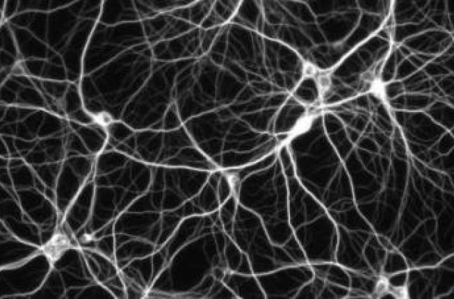 Collegamento a Parkinson, nuove armi per il trattamento della malattia